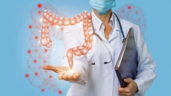 el-sindrome-de-peutz-jeghers,-un-trastorno-hereditario-que-aumenta-el-riesgo-de-cancer-de-colon