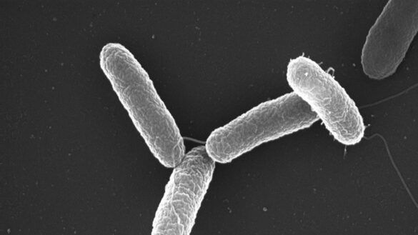 las-infecciones-bacterianas-cronicas-como-la-salmonela-aumentan-el-riesgo-de-padecer-cancer-de-colon