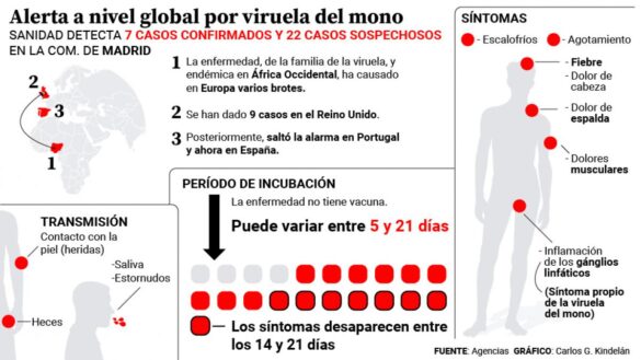 todo-sobre-los-brotes-de-viruela-del-mono-ya-detectados-en-espana:-¿como-se-contagia?-¿hay-riesgo-para-la-poblacion-general?