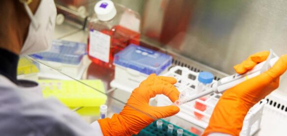 sanidad-confirma-98-casos-de-viruela-del-mono