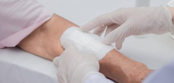 nanomedicina-para-que-las-heridas-recalcitrantes-cicatricen