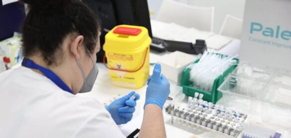 viruela-del-mono:-optimismo-con-prudencia