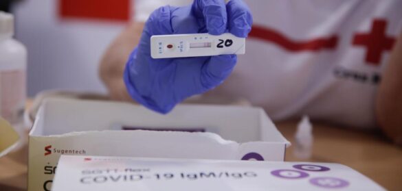 la-covid-sigue-a-la-baja,-77-casos-menos-que-hace-una-semana