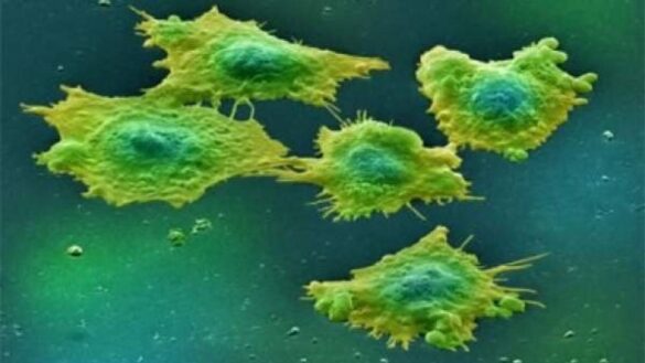 un-farmaco-logra-remitir-por-completo-el-cancer-en-todos-los-pacientes-de-un-estudio