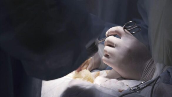 operacion-de-fimosis:-en-que-consiste-y-que-edad-es-la-mas-adecuada-para-realizarla