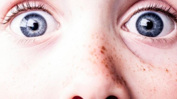 ¿cuando-les-salen-las-pecas-a-los-ninos?