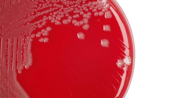 las-bacterias-de-la-fiebre-tifoidea-se-estan-volviendo-cada-vez-mas-resistentes-a-antibioticos-esenciales