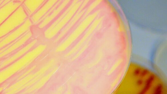 la-nueva-tecnica-para-luchar-contra-las-‘superbacterias’:-dejarlas-vivir