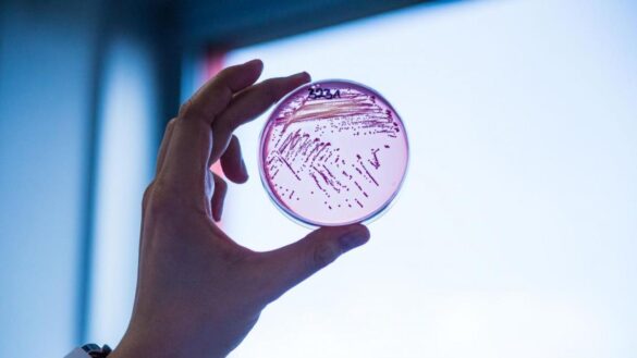 e.-coli-es-la-superbacteria-resistente-a-los-antibioticos-mas-comun-en-la-union-europea