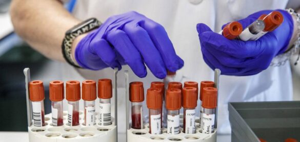 una-terapia-innovadora-permite-a-una-mujer-espanola-con-vih-vivir-sin-medicacion-antirretroviral