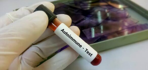 enfermedades-autoinmunes:-cuando-el-enemigo-es-uno-mismo