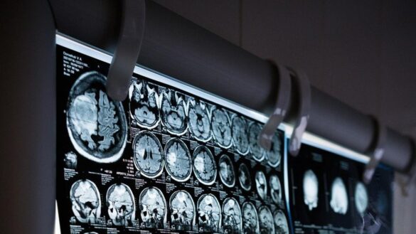 las-ventajas-y-las-desventajas-de-los-cerebros-de-las-personas-creativas,-segun-la-ciencia