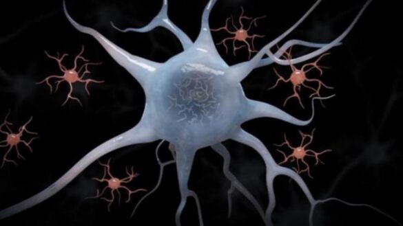 descubren-una-tecnica-que-podria-curar-celulas-defectuosas-causantes-del-alzheimer