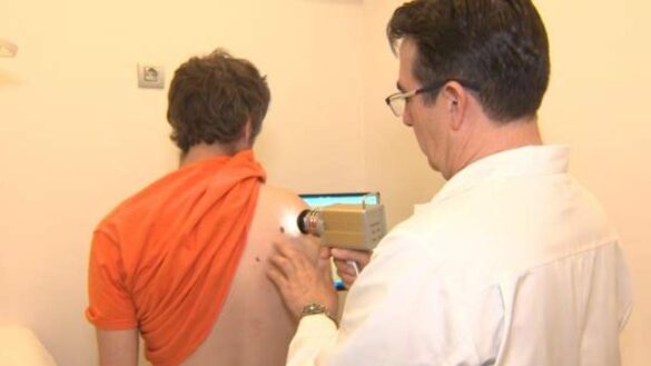 asi-son-los-nuevos-tratamientos-contra-el-cancer-de-piel