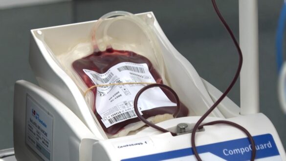 asi-influye-el-tipo-de-sangre-en-el-riesgo-de-sufrir-un-ictus-precoz