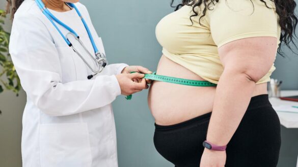 los-dos-tipos-de-obesidad-que-existen-y-cuales-son-las-caracteristicas-del-mas-grave