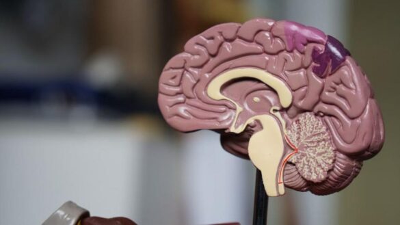 que-es-el-lecanemab,-el-farmaco-experimental-contra-el-alzheimer-que-reduce-el-deterioro-cognitivo