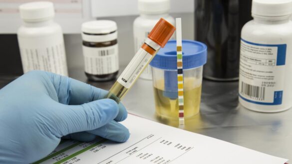 exito-de-un-nuevo-farmaco-contra-infecciones-urinarias-complicadas:-curo-al-79%-de-los-pacientes