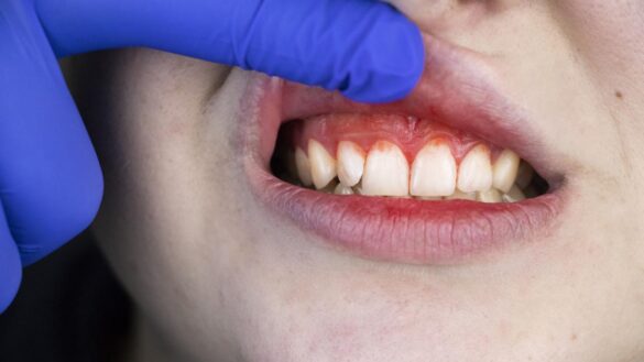 los-dentistas-alertan-del-peligro-de-ir-a-turquia-a-arreglarse-los-dientes-en-24-horas:-“puede-ser-desastroso”