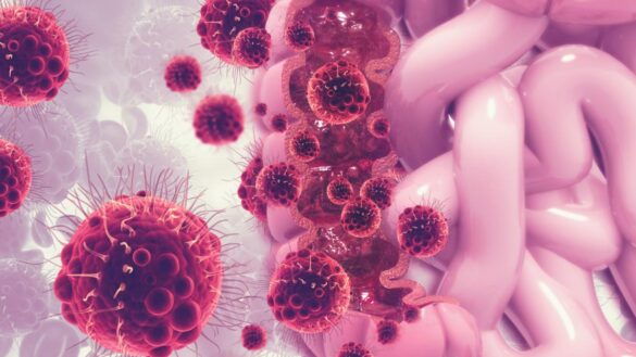 hallazgo-contra-el-cancer-de-colon:-identifican-un-biomarcador-que-detecta-la-enfermedad-en-sus-inicios