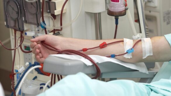 «una-epidemia-silenciosa»:-por-que-la-enfermedad-renal-cronica-aumento-un-30%-en-espana-en-10-anos