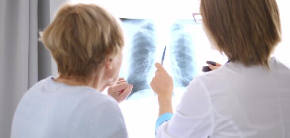 espana-esta-a-la-cabeza-europea-en-investigacion-sobre-el-cancer