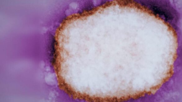 la-oms-cambia-el-nombre-de-la-viruela-del-mono-por-‘mpox’-para-evitar-el-«lenguaje-racista-y-estigmatizante»