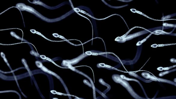 por-que-se-esta-reduciendo-el-numero-de-espermatozoides-en-los-hombres