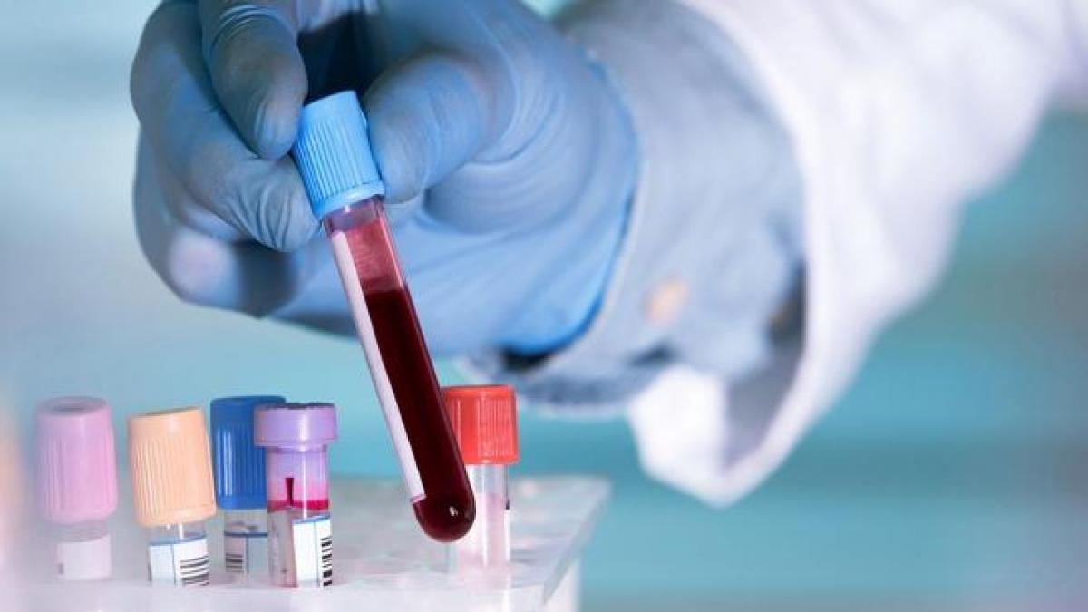 Un nuevo biomarcador puede permitir identificar hasta 14 tipos de cáncer a partir de un análisis de sangre