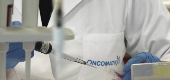 sanidad-alerta-de-mas-diagnosticos-de-cancer-por-el-impacto-de-la-covid