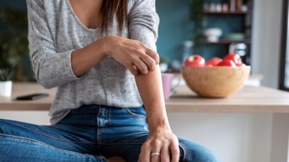 estos-son-los-metales-presentes-en-la-ropa-que-pueden-provocar-dermatitis-de-contacto