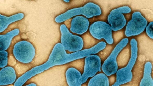 que-es-el-virus-de-marburgo,-la-peligrosa-enfermedad-emparentada-con-el-ebola-que-ha-provocado-un-brote-en-guinea-ecuatorial