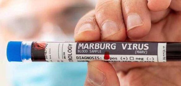 virus-de-marburgo,-una-amenaza-cercana,-real-y-mortal