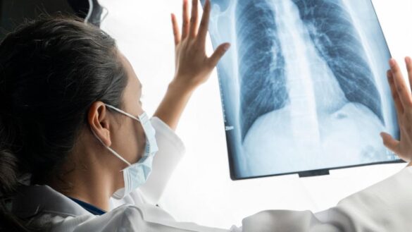 la-paradoja-del-cancer-en-espana:-aumentan-los-casos,-pero-desciende-la-tasa-de-mortalidad