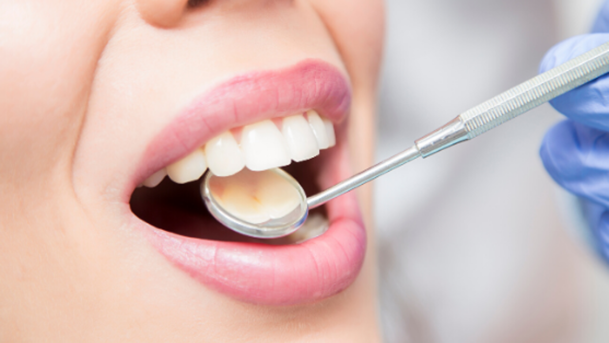 Caries: los dientes no solo se nos caen si abusamos del azúcar