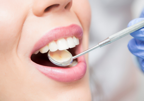 caries:-los-dientes-no-solo-se-nos-caen-si-abusamos-del-azucar