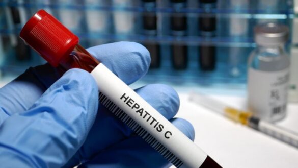 ¿se-puede-eliminar-la-hepatitis-c-antes-de-2030?-esta-es-la-apuesta-de-los-medicos