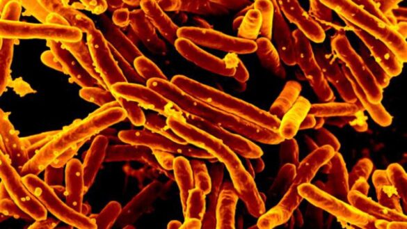 asi-es-la-tuberculosis,-una-de-las-‘superbacterias’-mas-peligrosas
