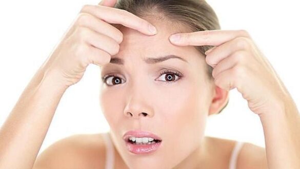 acne:-pros-y-contras-de-los-tratamientos