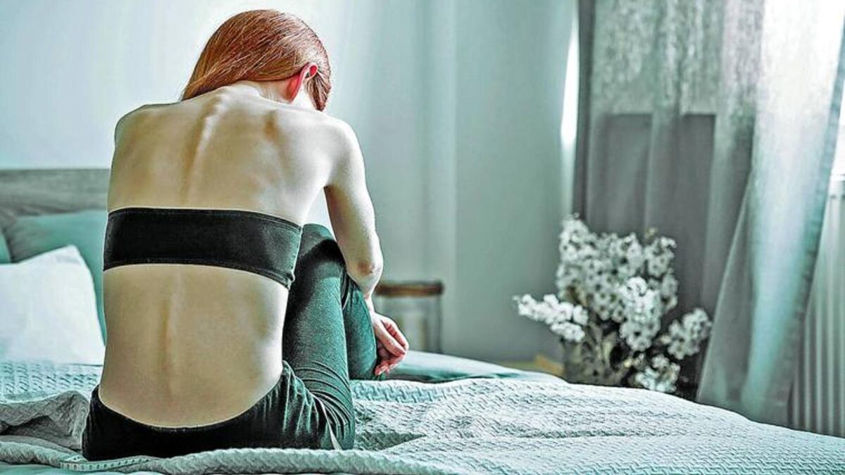 El calvario de llegar a pesar 44 kilos: «Yo a mi anorexia le llamo Ana»