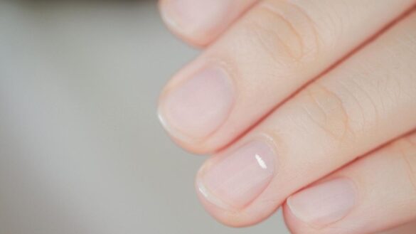 ¿por-que-me-salen-manchas-blancas-en-las-unas?-estas-son-las-posibles-causas