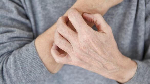 ¿te-han-aparecido-ronchas-en-la-piel?-estas-son-todas-las-causas-que-podrian-haberlas-provocado