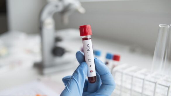 como-realizarse-una-prueba-de-vih-en-espana-y-por-que-es-una-buena-idea-hacerlo