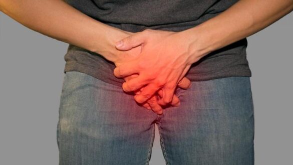 la-arana-que-provoca-una-larga-ereccion:-¿que-hay-que-saber-sobre-su-picadura?