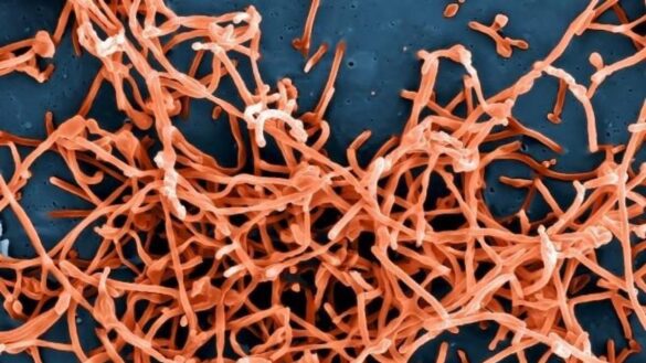 estos-son-los-sintomas,-causas-y-tratamiento-del-ebola,-una-peligrosa-enfermedad-de-la-que-se-ha-detectado-un-posible-caso-en-euskadi