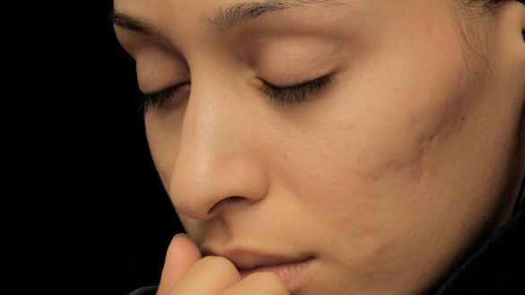 cancer-de-nariz:-primeros-sintomas,-tratamiento-y-como-puede-afectar-a-los-ninos