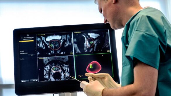 la-inteligencia-artificial-podra-decidir-el-mejor-tratamiento-para-el-cancer-de-prostata