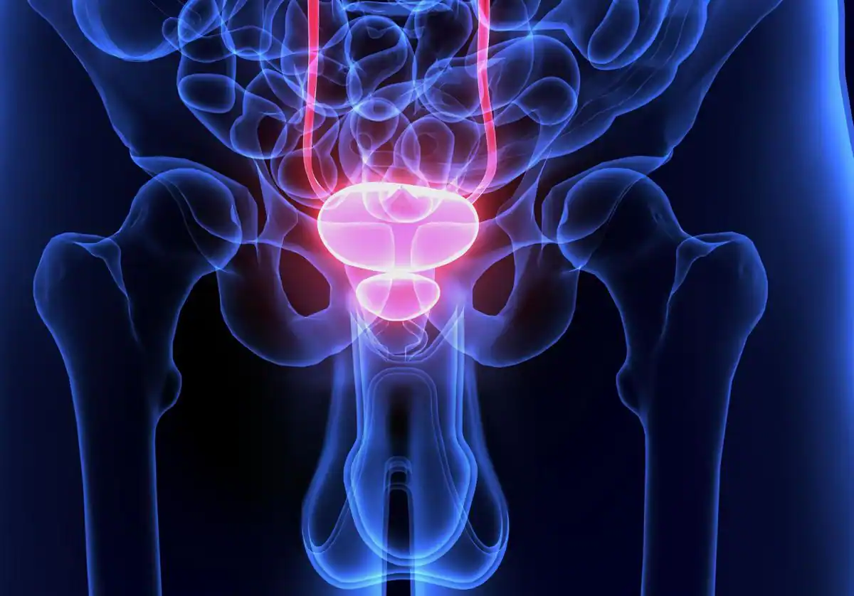 descubren-187-nuevas-variantes-geneticas-relacionadas-con-el-cancer-de-prostata