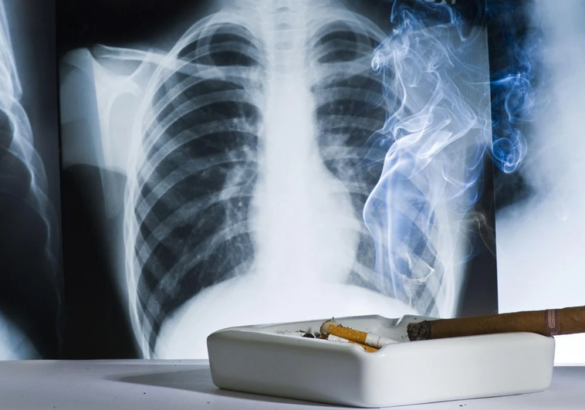 crecen-los-casos-de-cancer-de-pulmon-en-mujeres-y-personas-de-mediana-edad