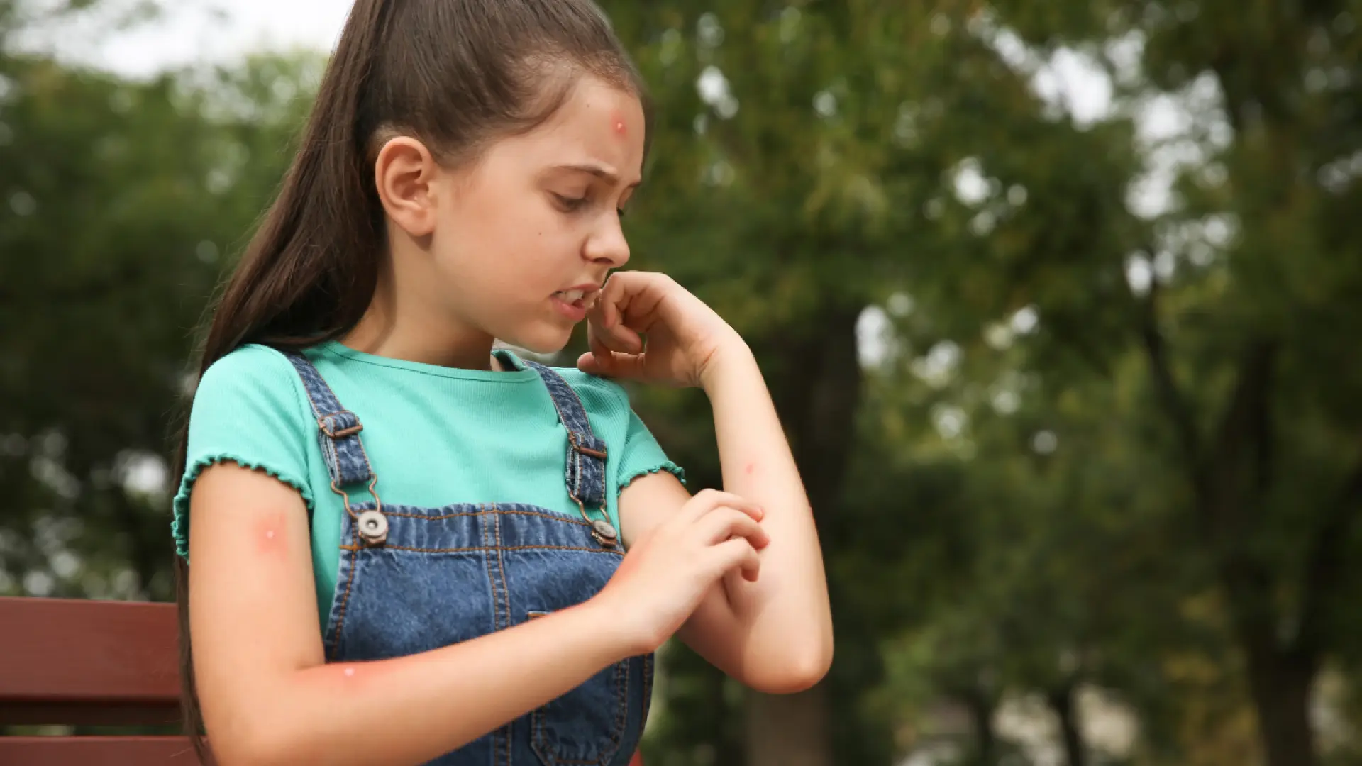 Picaduras en niños: cómo prevenirlas y qué hacer si ya han ocurrido